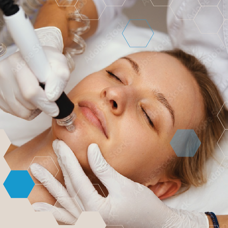 Woman getting laser treatment on her face.